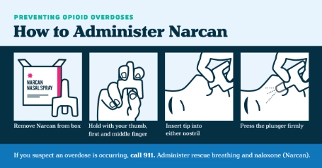 How to Administer Narcan